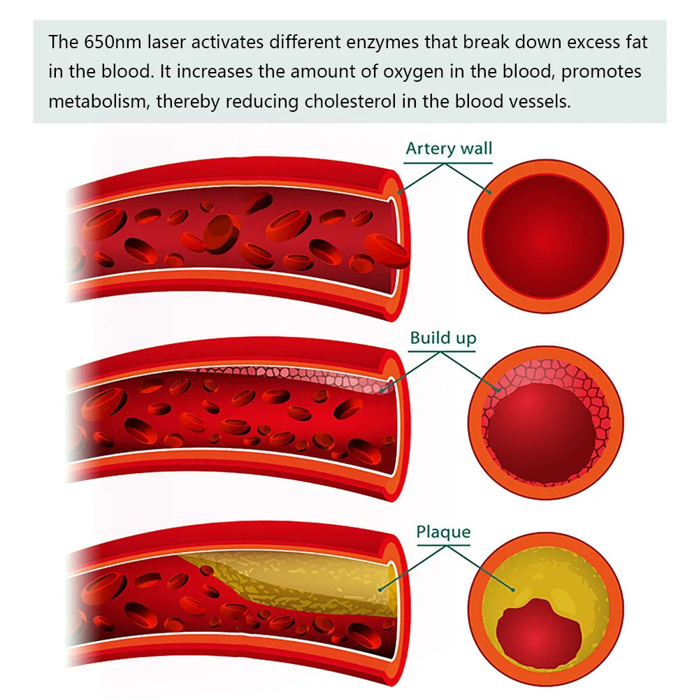 Acupuncture Moxibustion Therapy Cold Laser Diabetes